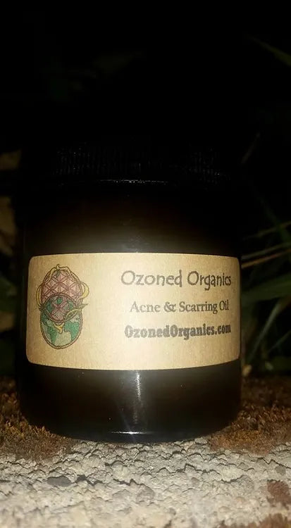 2oz & 4oz Olive Acne & Scarring Oil