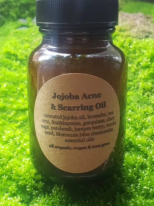 2oz Jojoba Acne & Scarring Oil